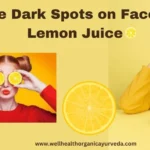 Wellhealthorganic.com Remove Dark Spots on Face Tang - Lemon Juice 